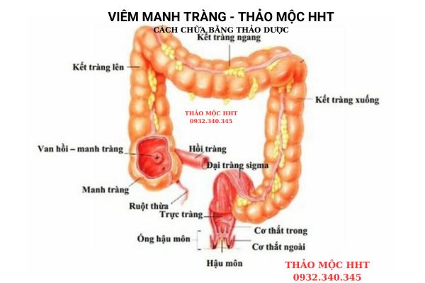 "cac-benh-lien-quan-viem-manh-trang"