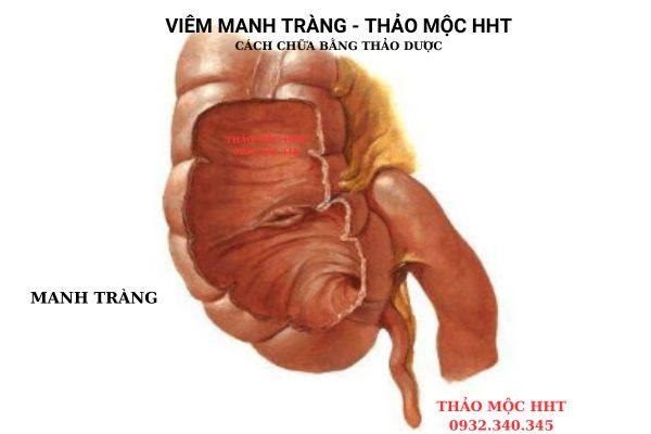 "giai phau manh trang"